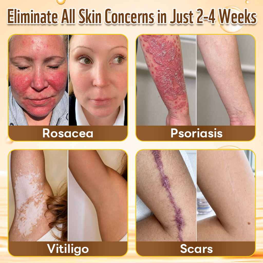 HISKIN® Multi-Concern Skin Repair Cream ✨ (One powerful cream to repair inflammation, dryness, aging, pigmentation, and visible skin damage.)