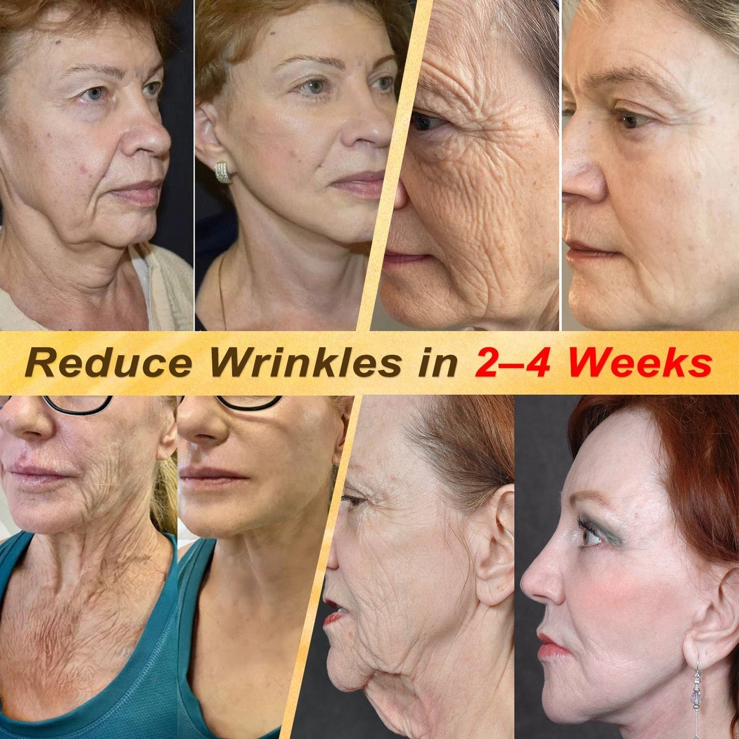 HISKIN® Multi-Concern Skin Repair Cream ✨ (One powerful cream to repair inflammation, dryness, aging, pigmentation, and visible skin damage.)