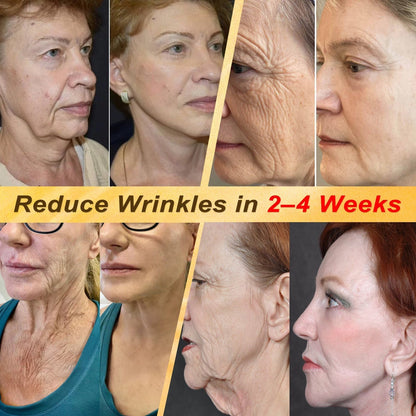 HISKIN® Multi-Concern Skin Repair Cream ✨ (One powerful cream to repair inflammation, dryness, aging, pigmentation, and visible skin damage.)