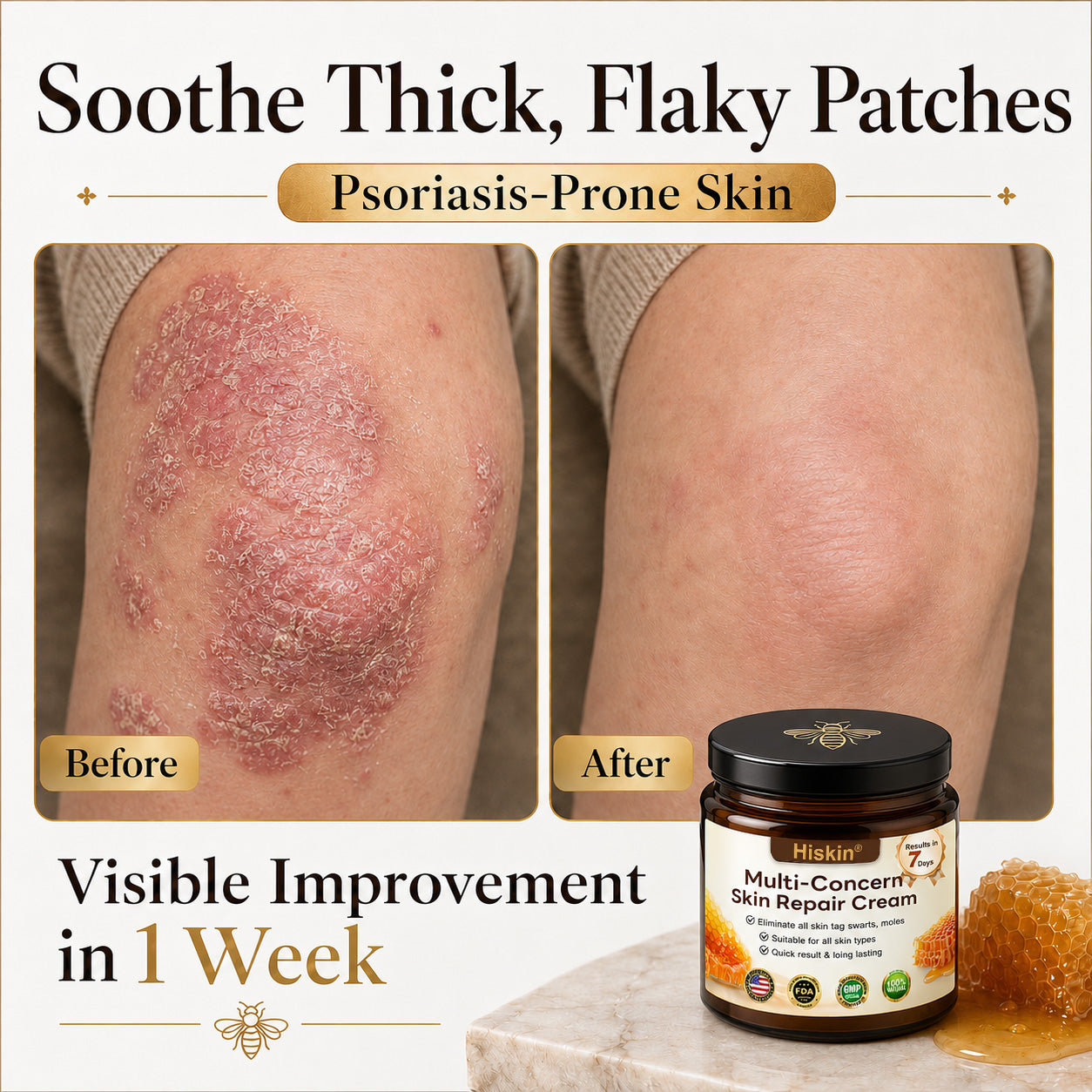 HISKIN® Multi-Concern Skin Repair Cream ✨ (One powerful cream to repair inflammation, dryness, aging, pigmentation, and visible skin damage.)