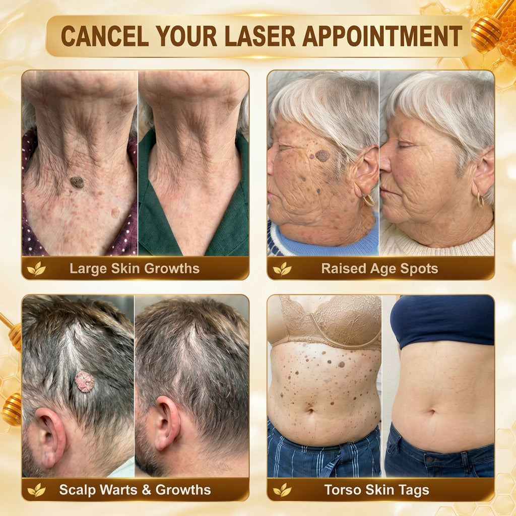 HISKIN® Multi-Concern Skin Repair Cream ✨ (One powerful cream to repair inflammation, dryness, aging, pigmentation, and visible skin damage.)